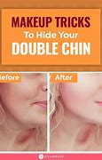 Image result for Double Chin Side View