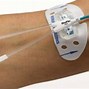Image result for Pediatric Power PICC