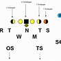 Image result for 5-2 Defense Football