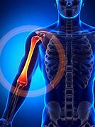 Image result for Arm Joint Snap