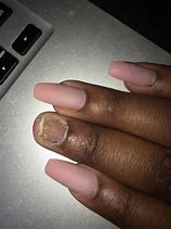 Image result for Nail Pushed Right into Nail Bed Because of Acrylic Nails