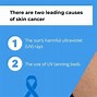 Image result for Skin Cancer Growth
