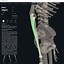 Image result for Ulna Bone Location