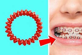 Image result for How to Make Fake Braces without Earring Backs