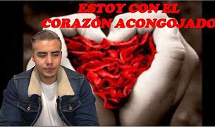 Image result for acongojacor