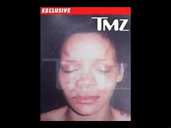 Image result for Rihanna Beaten Chris Brown