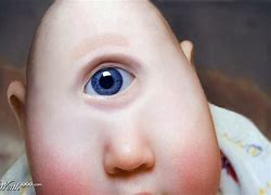 Image result for 1 Eyed Baby Cyclopia
