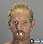 Image result for People with Funny Teeth