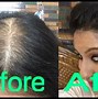 Image result for Bald Crown Haircut