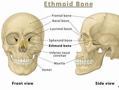 Image result for Ethmoid Bone Diagram