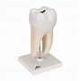 Image result for Molar Teeth Roots Sketch