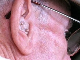 Image result for Hearing Aid Earrings