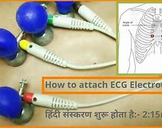Image result for ECG Lead Wires