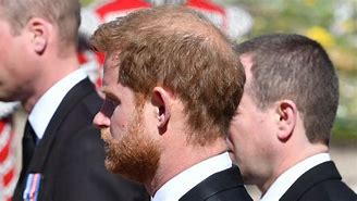 Image result for Prince Harry's Bald Head