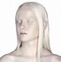 Image result for Albino People Eyes