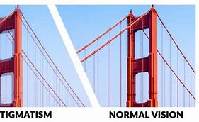 Image result for Examples of Astigmatism Vision