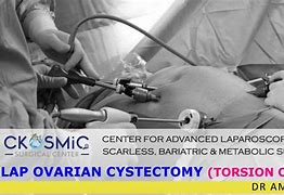 Image result for Laparoscopic Ovarian Cyst