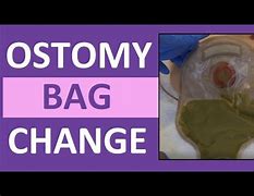 Image result for Ostomy Armor