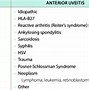 Image result for Hyphema vs Hypopyon