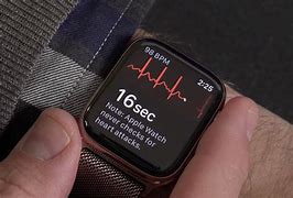 Image result for ECG Feature Apple Watch