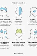 Image result for Head Pain Right Side