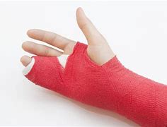 Image result for Broken Finger Cast