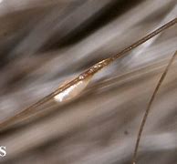 Image result for What Does a Dead Lice Egg Look Like