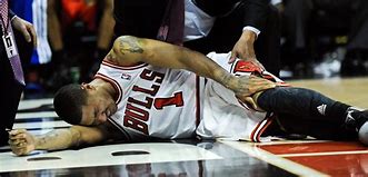 Image result for Derrick Rose Knee