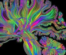 Image result for Cool Human Brain