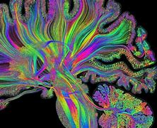 Image result for Artistic Brain