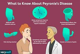 Image result for What Does Peronies Condition Look Like
