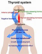 Image result for Thyroid Control Diet