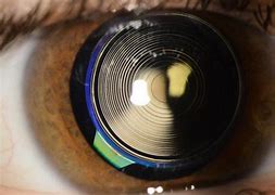 Image result for Intraocular Lens Replacement