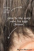 Image result for What Does a Brown Lice Look Like