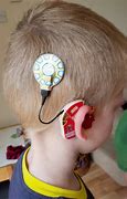 Image result for Kids with Hearing Aids