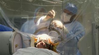 Image result for Brain Surgery Recovery