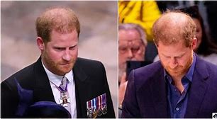 Image result for Prince Harry Hair