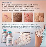 Image result for Dark Genital Warts