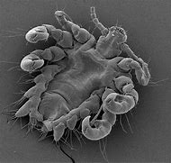 Image result for Crab Louse in Microscope