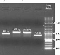 Image result for DNA Gel Electrophoresis Results