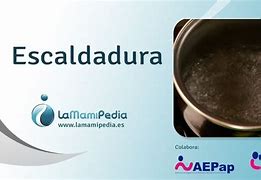 Image result for escaldadura