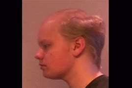 Image result for Distorted Bald Man