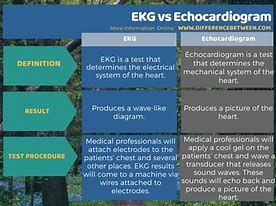 Image result for Echocardiogram vs EKG