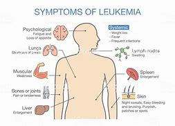 Image result for Leukemia Rash Symptoms in Adults