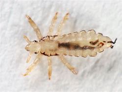 Image result for Head Louse