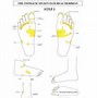 Image result for Peripheral Neuropathy Feet
