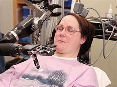 Image result for Robotic Arm for Human Arm