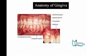 Image result for Gingival Mucosa