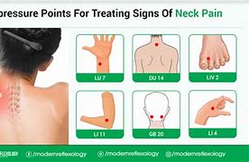 Image result for Acupuncture Neck