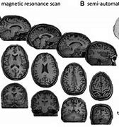 Image result for Human Brain Shrinking